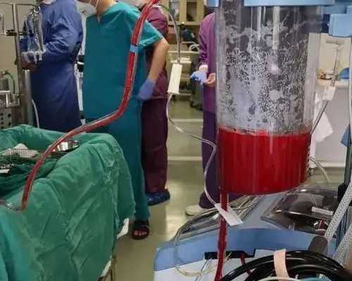 贵阳辅助生殖：试管婴儿胚胎移植全流程解析，兼论供卵代生与代怀选择