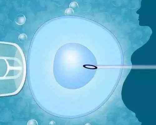 贵阳试管助孕：深度解析安全保障、费用明细与代怀选择